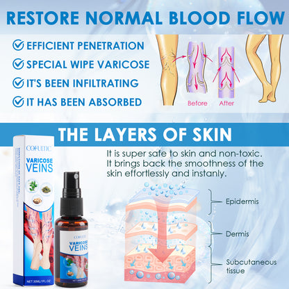 30ml Varicose Vein Spray